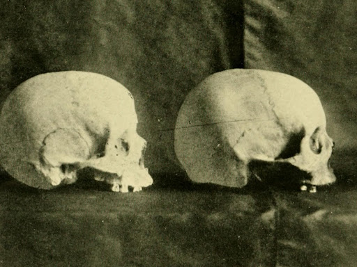 human skulls