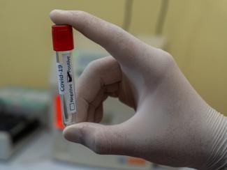 Empty blood tube with Positive Coronavirus label