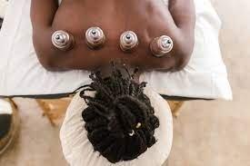 black person with cupping on their back
