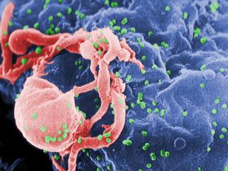 hiv virus under a microscope