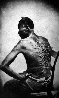 Man with scars on back