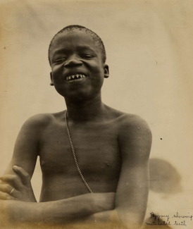 young boy showing sharpened teeth