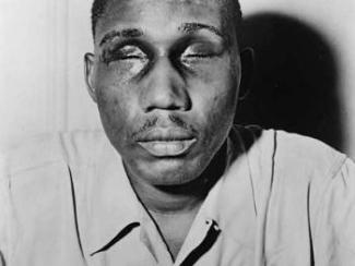 photo of isaac woodard after being beaten by police officers eyes swollen shut